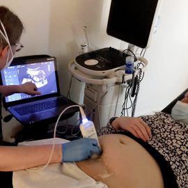 Mobile Sonographer in Himo (4): that’s how we’re going to do it!